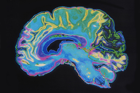 human brain in cross section
