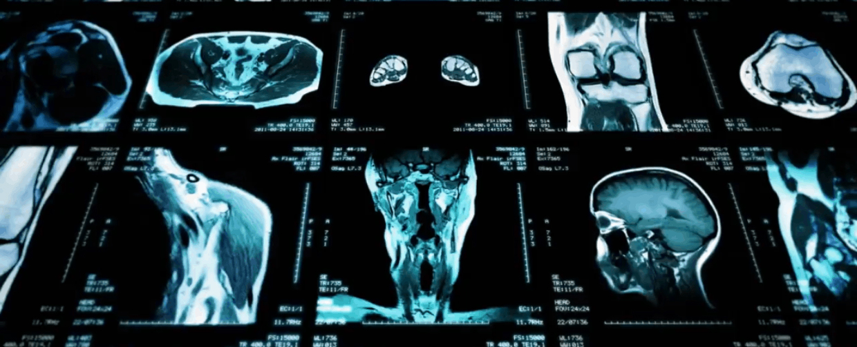 radiology images