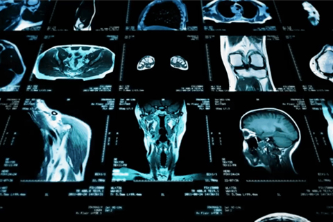 radiology images